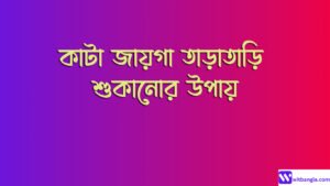 Read more about the article কাটা জায়গা তাড়াতাড়ি শুকানোর উপায়